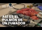 Así se transforma el pulmón de un fumador | Recurso educativo 788328